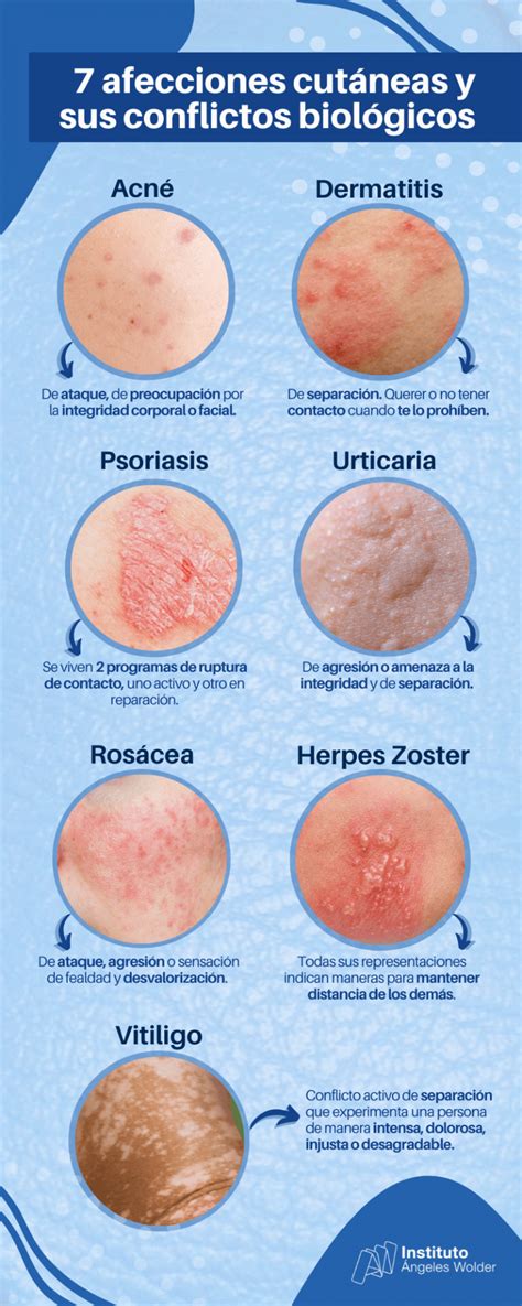 Infografía mostrando diferentes tipos de afecciones de la piel.
