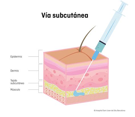 Ilustración de la capa subcutánea de la piel con una inyección