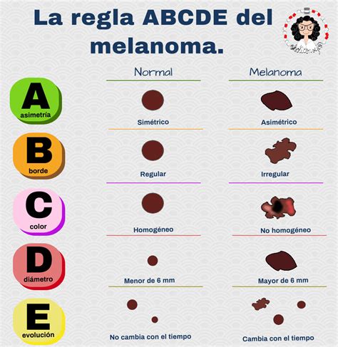Diagrama ABCDE para la detección del melanoma